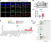 The cGAS/STING pathway is active in microglia/macrophages in human nAMD and