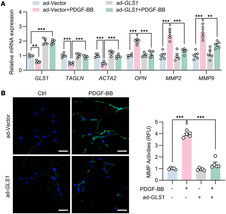 GLS1 overexpression preserves the contractile phenotype of VSMCs in resp...