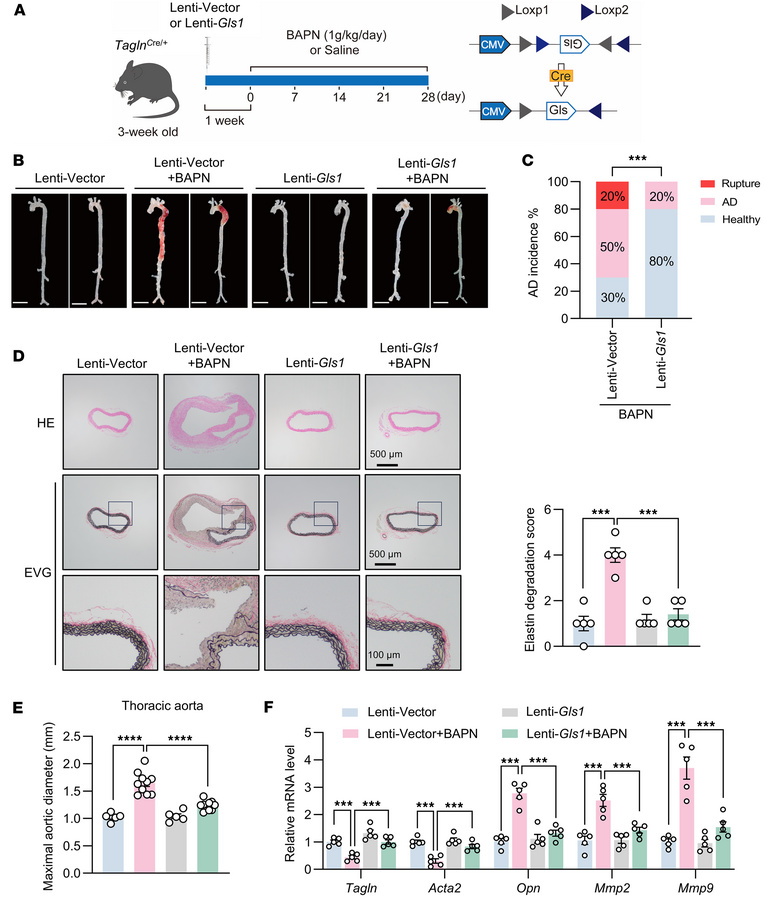 Overexpression of GLS1 in VSMCs attenuates AD in BAPN-treated mice.
(A) ...