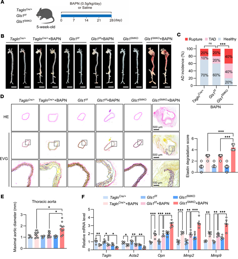 GLS1 deficiency in VSMCs aggravates AD in BAPN-treated mice.
(A) Five-we...