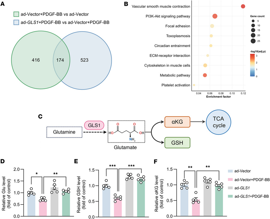 GLS1 regulates glutamine metabolism during VSMC phenotypic switching.
(A...