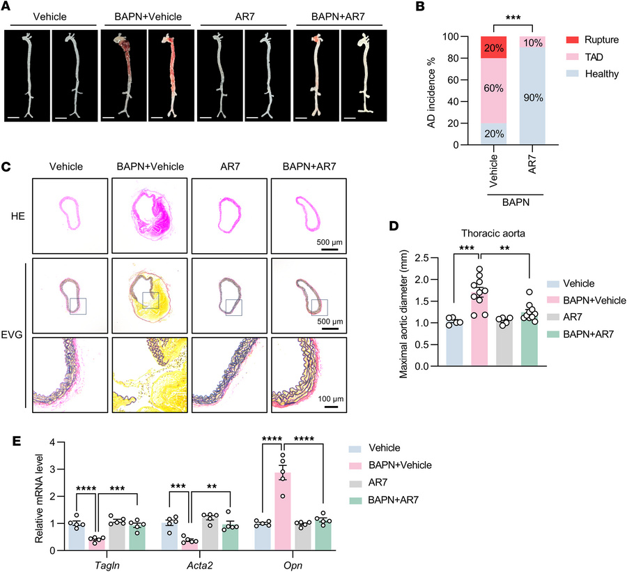 The RARα inhibitor AR7 attenuates AD in BAPN-treated mice.
(A–E) Three-w...