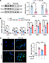 GLS1 knockdown promotes phenotypic switching of VSMCs in response to PDGF-B