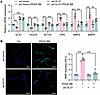 GLS1 overexpression preserves the contractile phenotype of VSMCs in respons