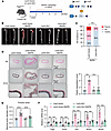 Overexpression of GLS1 in VSMCs attenuates AD in BAPN-treated mice.