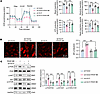 GLS1 modulates mitochondrial function and PI3K/AKT/mTOR signaling during VS