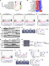 GLS1 maintains amino acid pools and redox homeostasis to support mTORC1 act