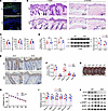 Keratinocyte-specific Gls1 deletion does not disrupt normal skin developmen