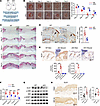 GLS1-mediated glutaminolysis supports injury-induced keratinocyte prolifera