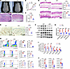 Keratinocyte-specific Gls1 deletion attenuates psoriasiform skin inflammati