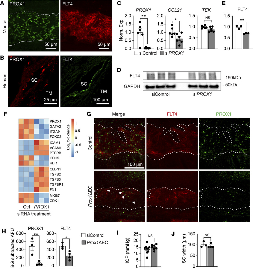 Human and mouse Schlemm’s canal endothelial cells share a lymphatic-like...