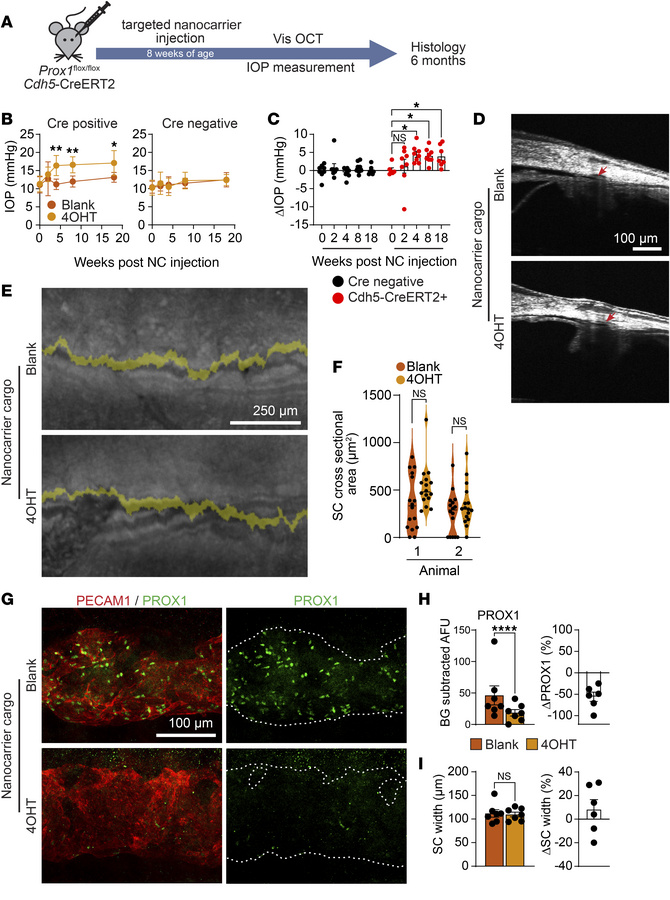 Schlemm’s canal–specific Prox1 deletion leads to ocular hypertension.
(A...