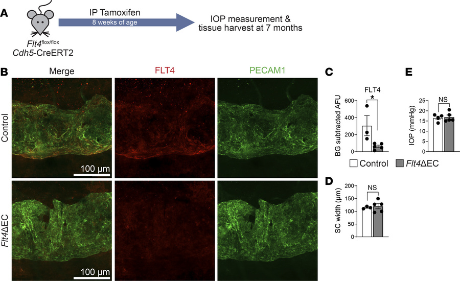 FLT4 is not required for Schlemm’s canal maintenance or IOP homeostasis ...