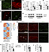 Human and mouse Schlemm’s canal endothelial cells share a lymphatic-like hy