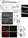 Schlemm’s canal–specific Prox1 deletion leads to ocular hypertension.