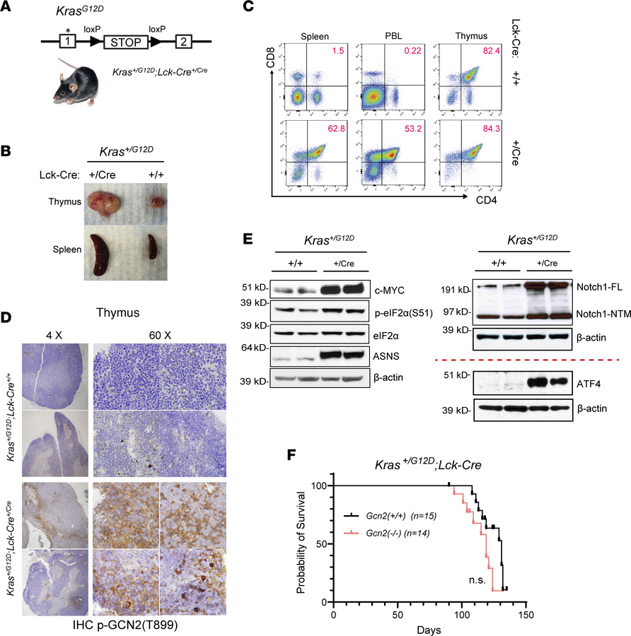 GCN2 is not required for leukemogenesis.
(A) Schematic diagram of T-ALL ...