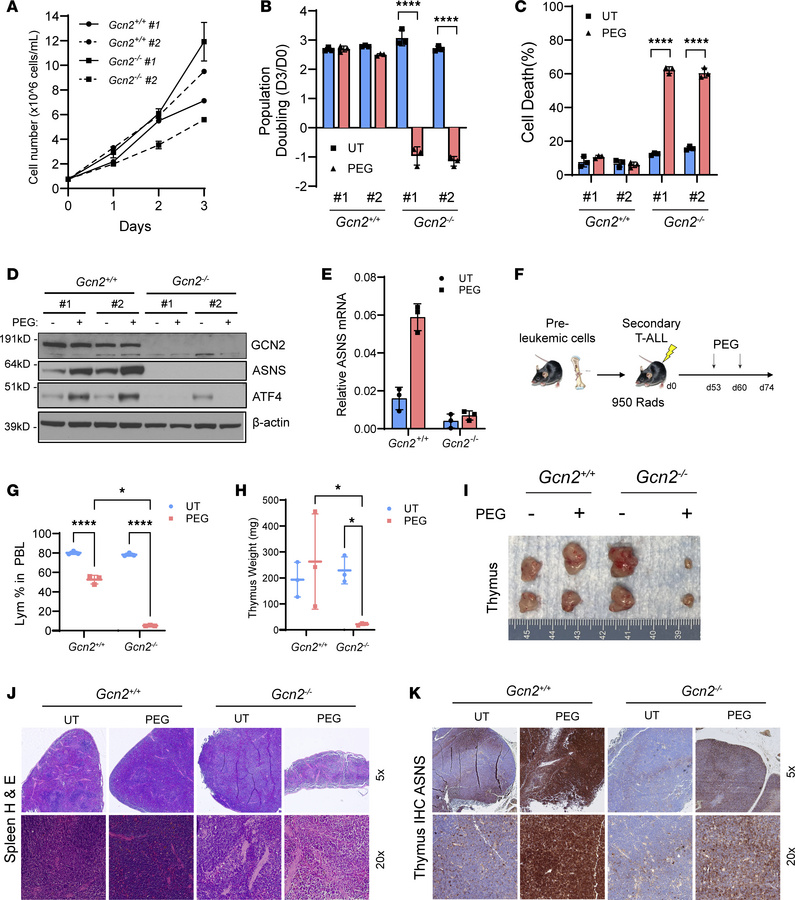 GCN2 deficiency sensitizes ALL cells to asparagine depletion.
(A) Gcn2+/...