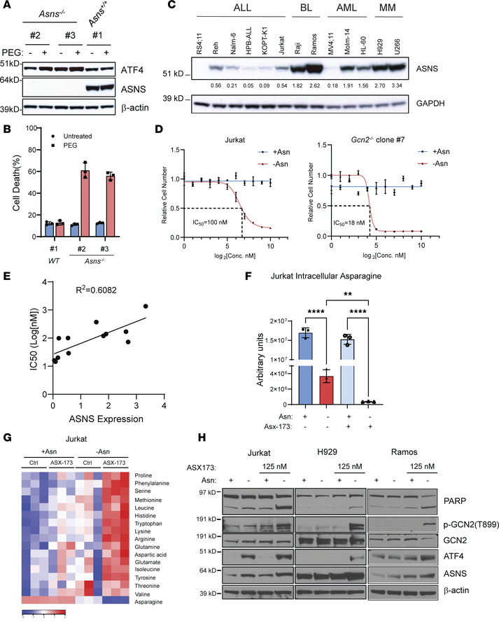 ASX-173 overcomes L-asparaginase resistance in ALL cells due to induced ...