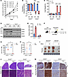 GCN2 deficiency sensitizes ALL cells to asparagine depletion.