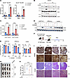 A small-molecule inhibitor of GCN2 sensitizes ALL cells to asparagine deple