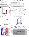 ASX-173 overcomes L-asparaginase resistance in ALL cells due to induced ASN