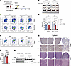 ASX-173 reduces leukemic burden in an ASNS-high ALL model when coupled with