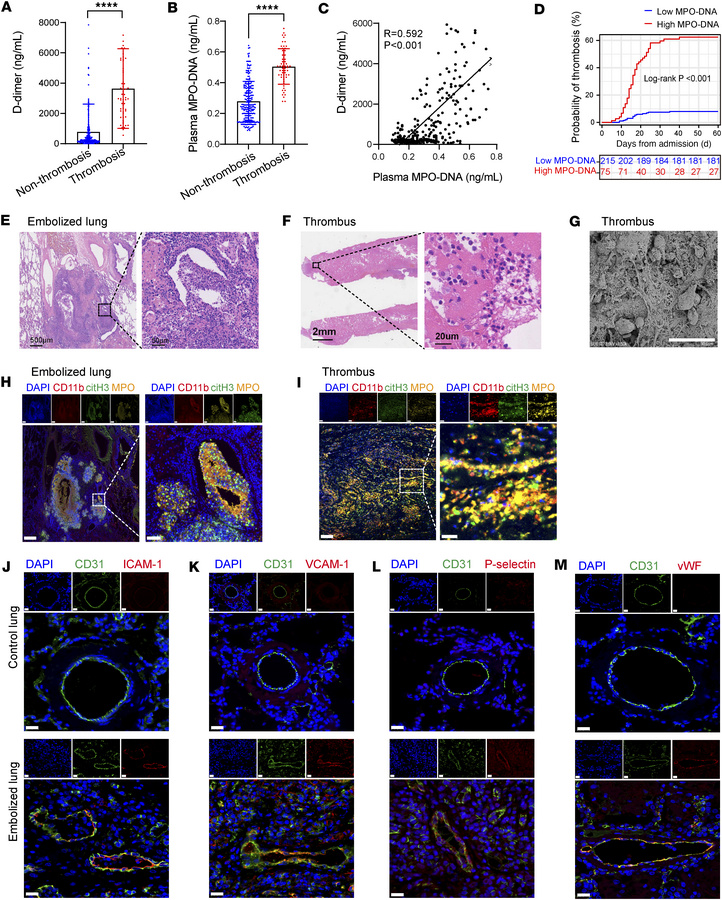 NETs and endothelial activation in blood samples and lung tissues from p...