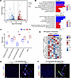 Mycoplasma pneumoniae (MP) promotes neutrophil NETs formation.