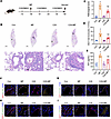 TLR2 inhibition ameliorates endothelial activation in MPP mice (n = 6 mice