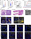 NETs and endothelial activation in blood samples and lung tissues from pati