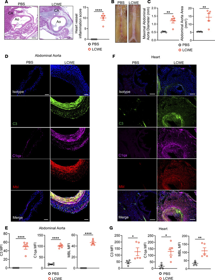 Increased protein levels of complement arms in LCWE-induced murine KD.
(...