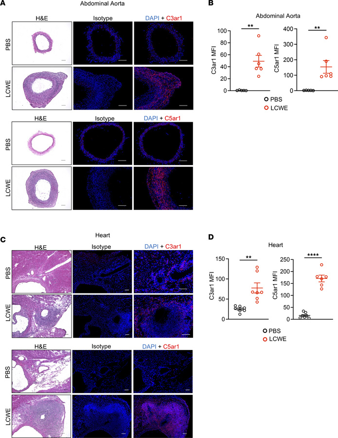 Protein levels of complement pathway receptors are elevated in cardiovas...