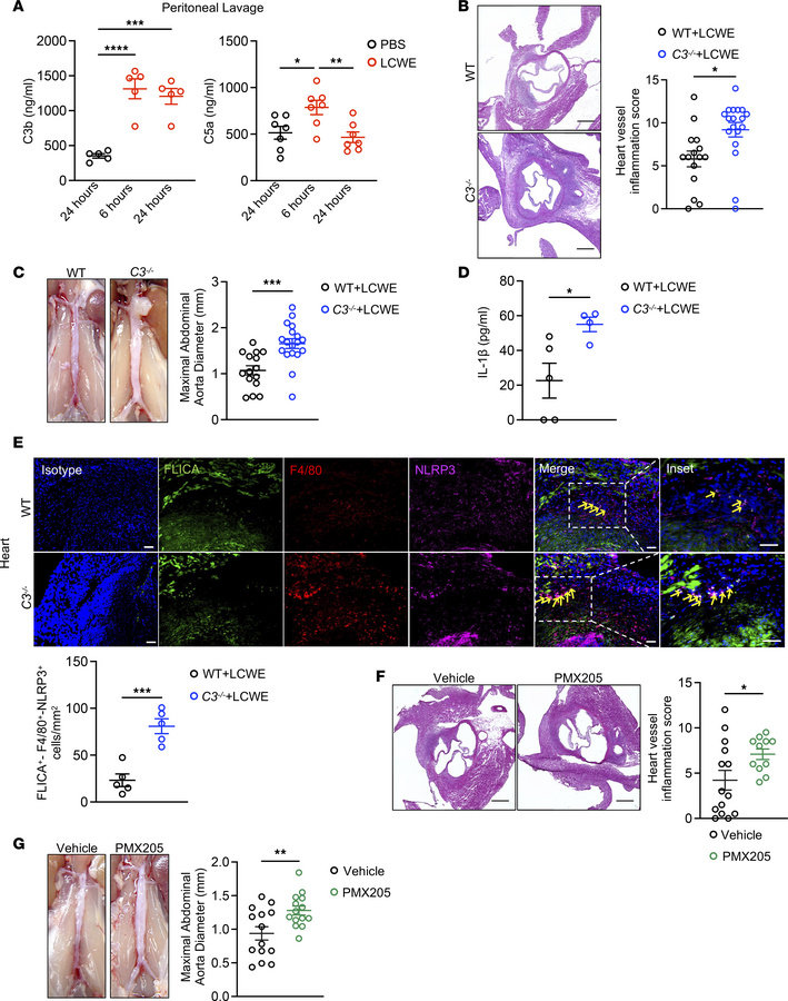 C3 deficiency or C5a receptor blockade exacerbates murine KD vasculitis....