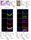 Increased protein levels of complement arms in LCWE-induced murine KD.