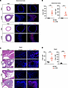 Protein levels of complement pathway receptors are elevated in cardiovascul