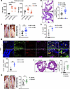 C3 deficiency or C5a receptor blockade exacerbates murine KD vasculitis.