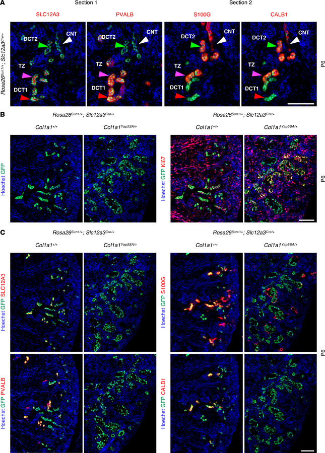 Constitutive activation of YAP in the DCT and CNT leads to increased pro...