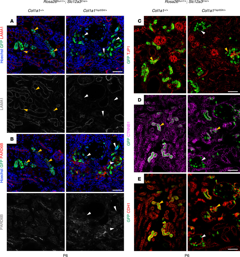 Constitutive activation of YAP in DCT and CNT impairs epithelial polarit...