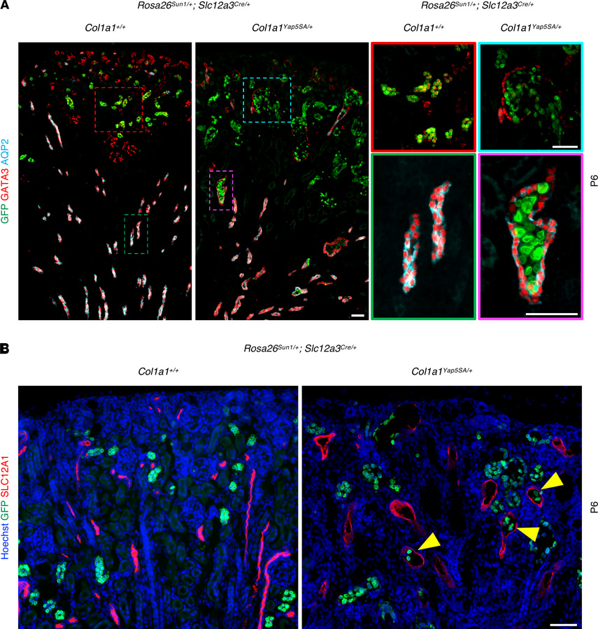 Constitutive YAP activation in DCT and CNT is associated with displaceme...