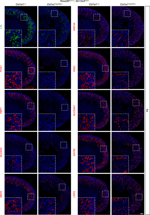 Constitutive YAP activation in DCT and CNT leads to the downregulation o...