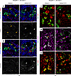Constitutive activation of YAP in DCT and CNT impairs epithelial polarity a
