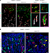 Constitutive YAP activation in DCT and CNT is associated with displacement