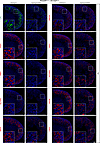 Constitutive YAP activation in DCT and CNT leads to the downregulation of p