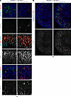 YAP activation in DCT and CNT cells induces tubular injury and macrophage i