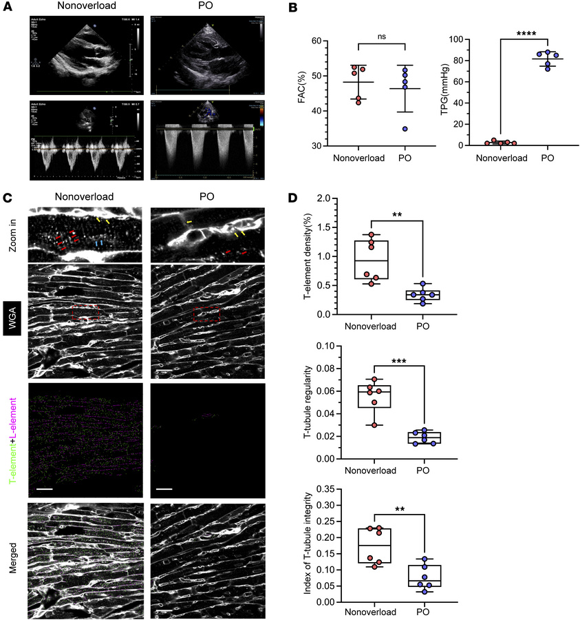 T-tubule maturation deficit in pediatric patients with RVPO.
(A) Represe...