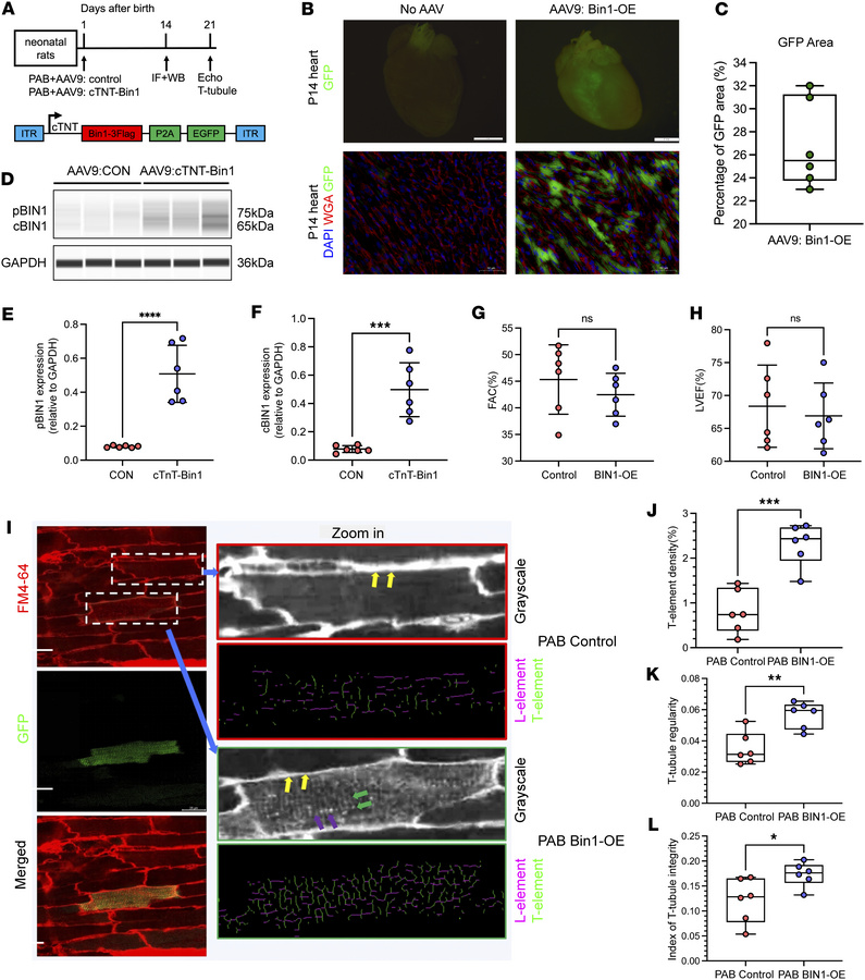 BIN1 overexpression rescues T-tubule maturation in neonatal RVPO rats.
(...