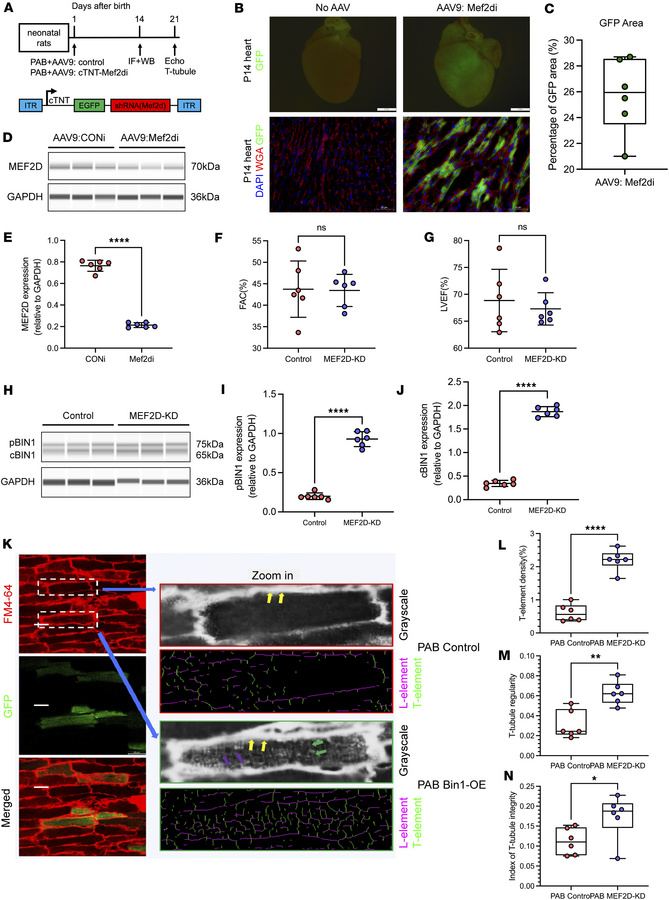 MEF2D knockdown rescues T-tubule maturation in neonatal RVPO rats.
(A) S...