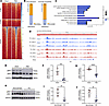 RVPO alters chromatin accessibility of T-tubule–associated genes.
