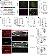 BIN1 overexpression rescues T-tubule maturation in neonatal RVPO rats.