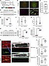 MEF2D knockdown rescues T-tubule maturation in neonatal RVPO rats.